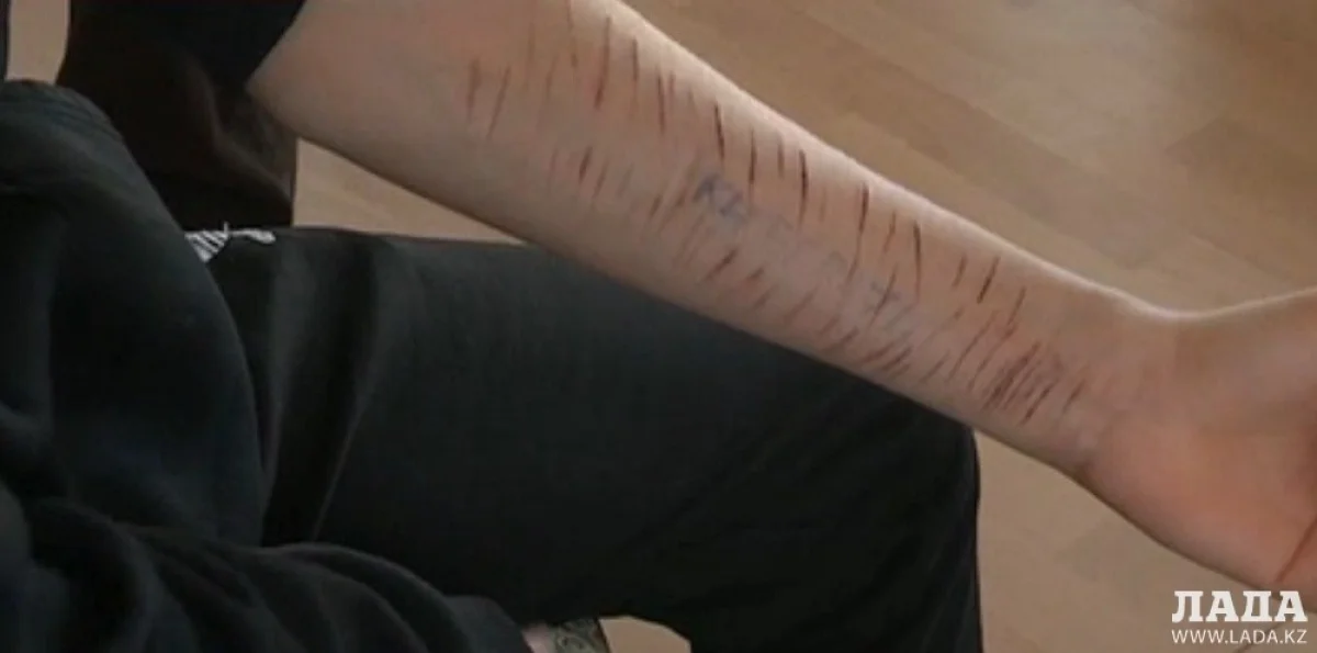 Подросток нанес себе более 70 порезов. Скриншот видео