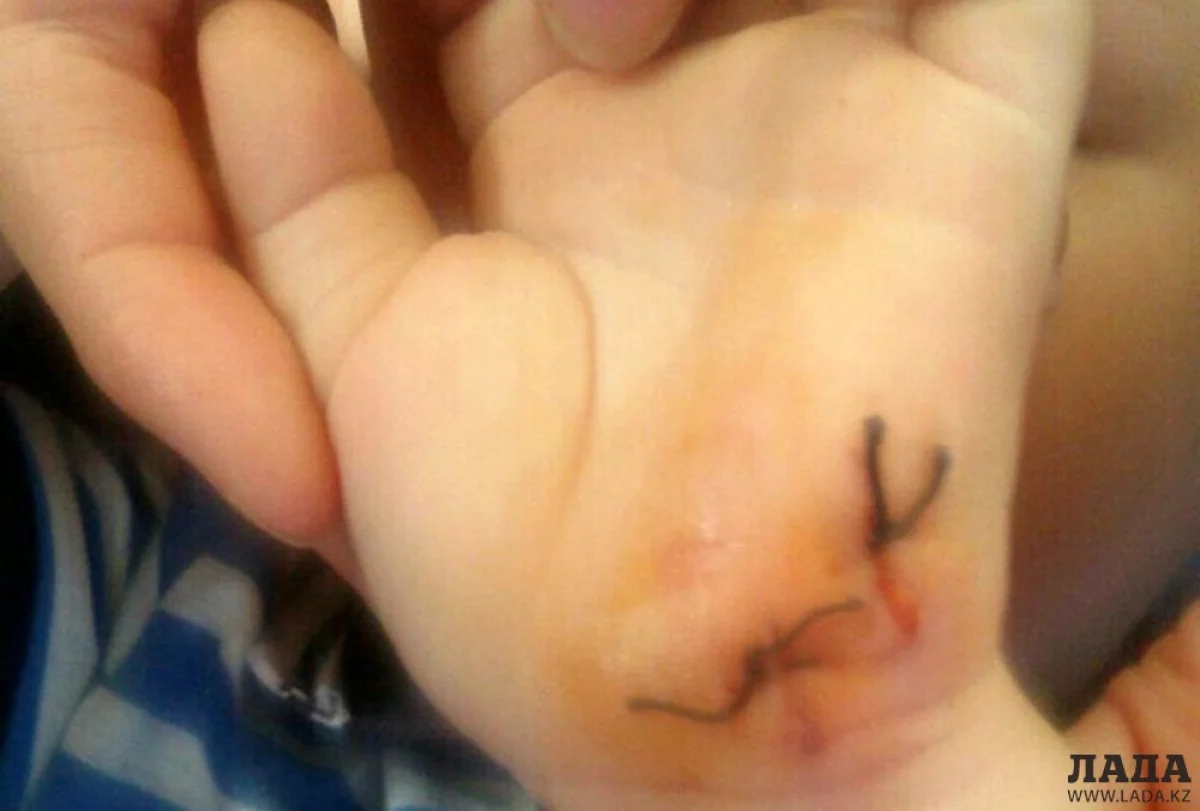 Фото предоставила мама пострадавшего ребенка