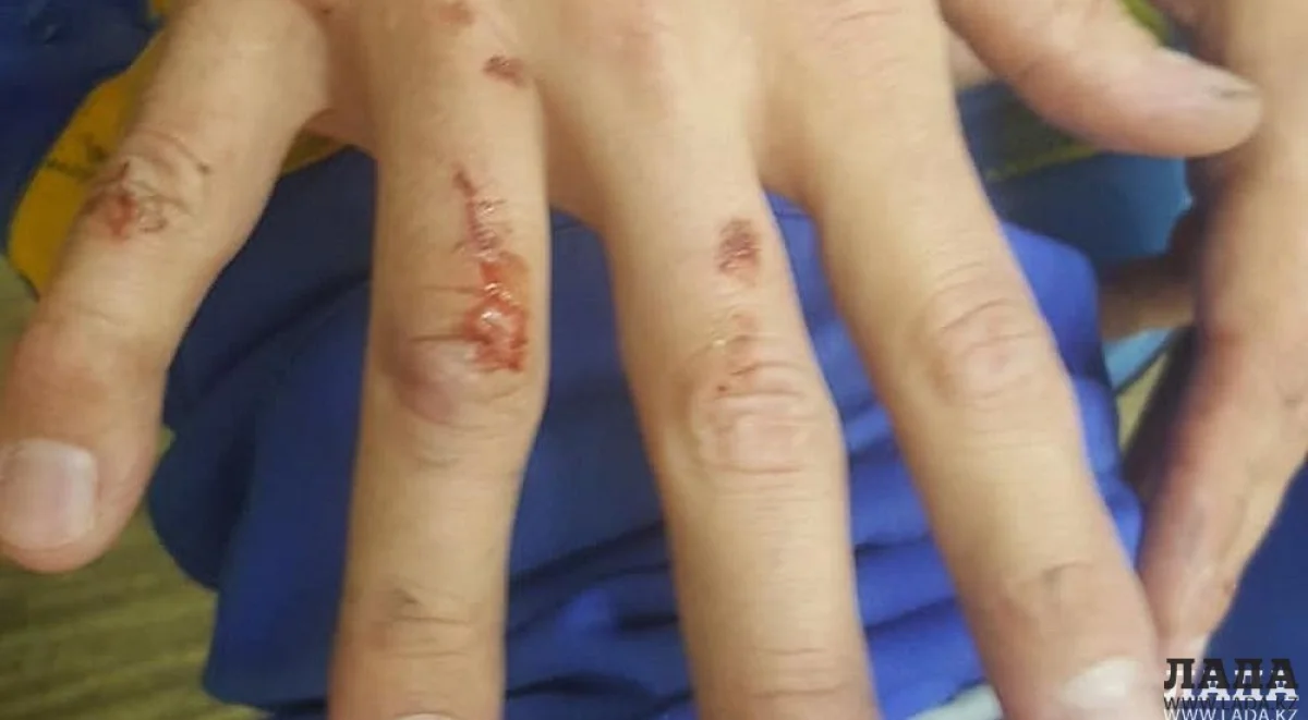 Фото потерпевшего велосипедиста||news_pic_more|<!--TBegin--><a href="https://www.lada.kz/uploads/posts/2018-11/1541666464_600a3e6c-5b53-4975-8d3e-12b681bff9d1.jpg" onclick="return hs.expand(this)" ><img align="left" src="https://www.lada.kz/uploads/posts/2018-11/thumbs/1541666464_600a3e6c-5b53-4975-8d3e-12b681bff9d1.jpg" alt='Автобус сбил велосипедиста в Актау' title='Автобус сбил велосипедиста в Актау'  /></a><!--TEnd--><br /><!--TBegin--><a href="https://www.lada.kz/uploads/posts/2018-11/1541666520_a1af6065-cbe5-41fc-89fb-c54c7d6a9c09.jpg" onclick="return hs.expand(this)" ><img align="left" src="https://www.lada.kz/uploads/posts/2018-11/thumbs/1541666520_a1af6065-cbe5-41fc-89fb-c54c7d6a9c09.jpg" alt='Автобус сбил велосипедиста в Актау' title='Автобус сбил велосипедиста в Актау'  /></a><!--TEnd--><br />