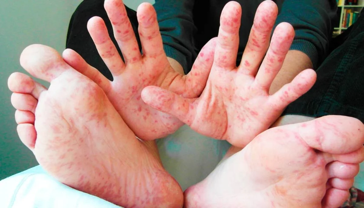 Фото etcetera.media