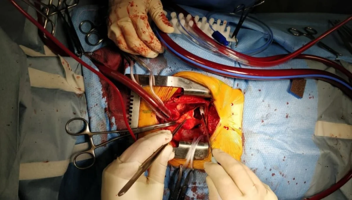 Момент операции. Фото предоставлено Е.Ордабаевым