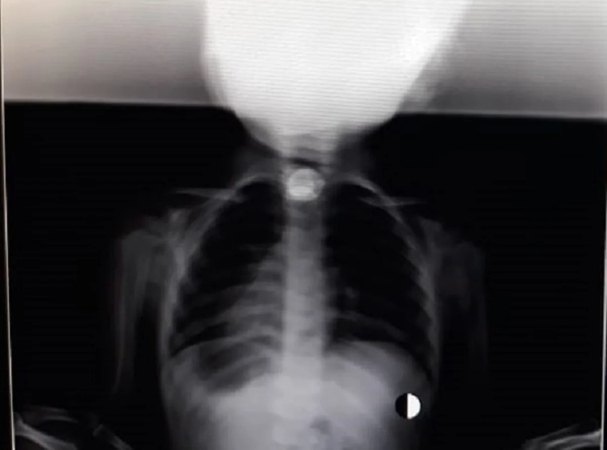 Фото предоставлено в управлении здравоохранения Мангистауской области