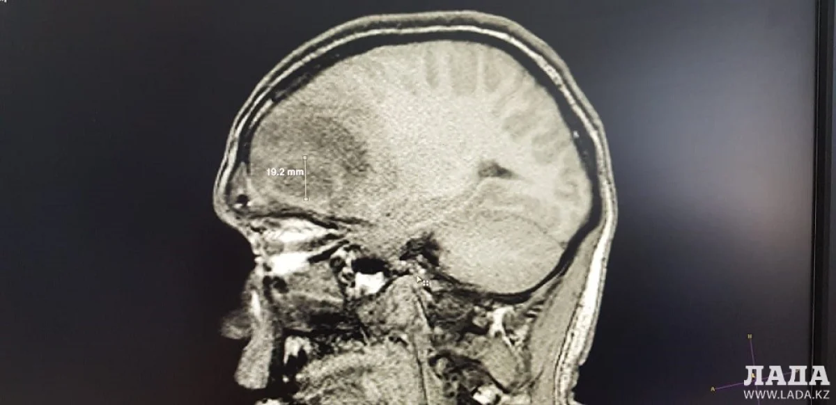 Фото предоставлено пресс-службой управления здравоохранения Мангистауской области