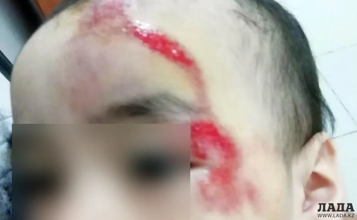 Фото предоставила семья пострадавшего мальчика