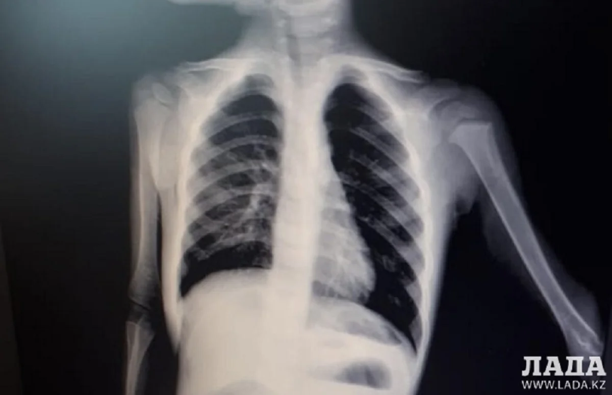 Фото пресс-службы управления здравоохранения Мангистау