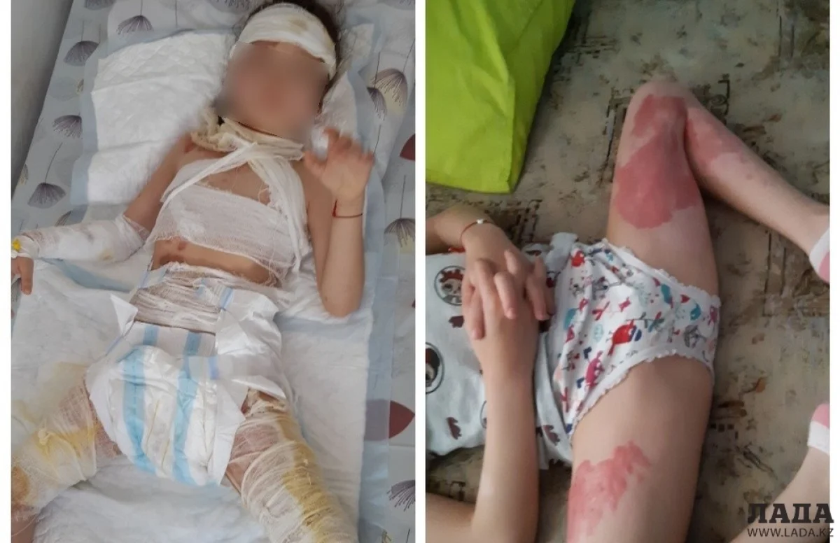 Пострадавшая шестилетняя девочка