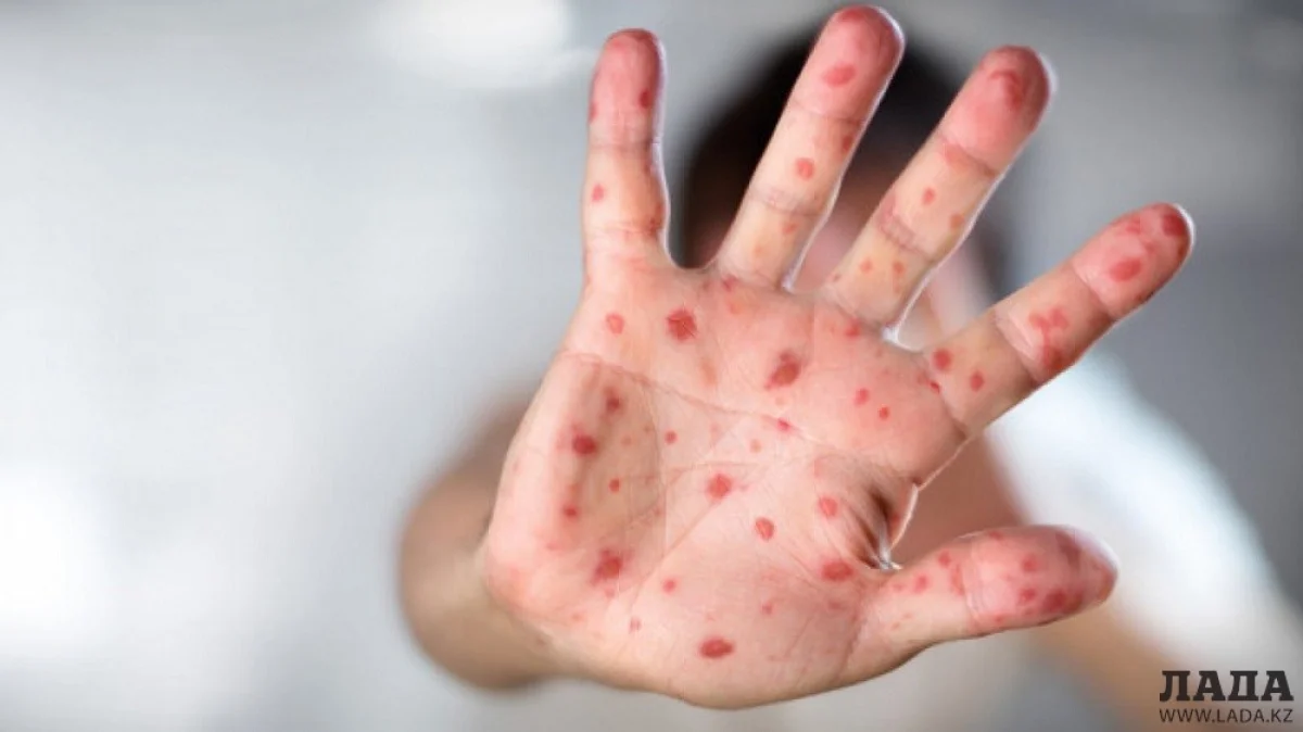 Иллюстративное фото с сайта zakon.kz