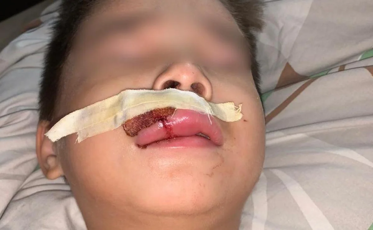 Фото предоставили родственнии мальчика