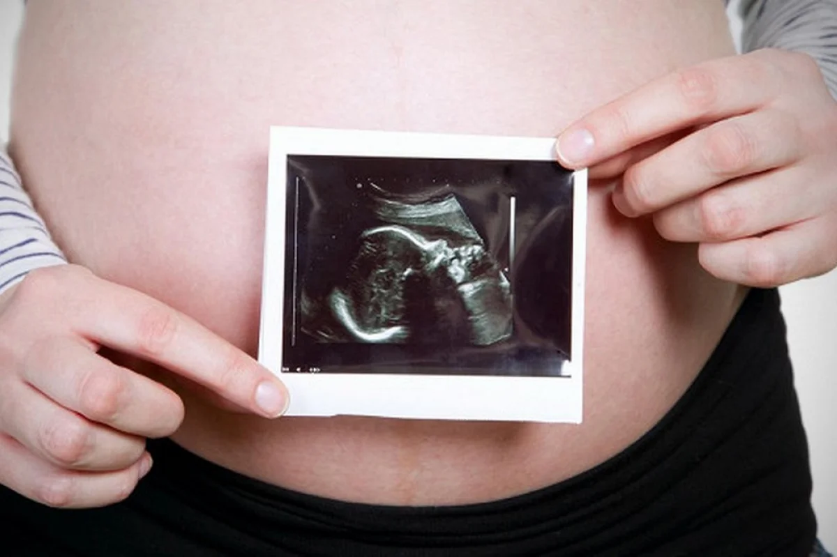 Иллюстративное фото с сайта naked-science.ru