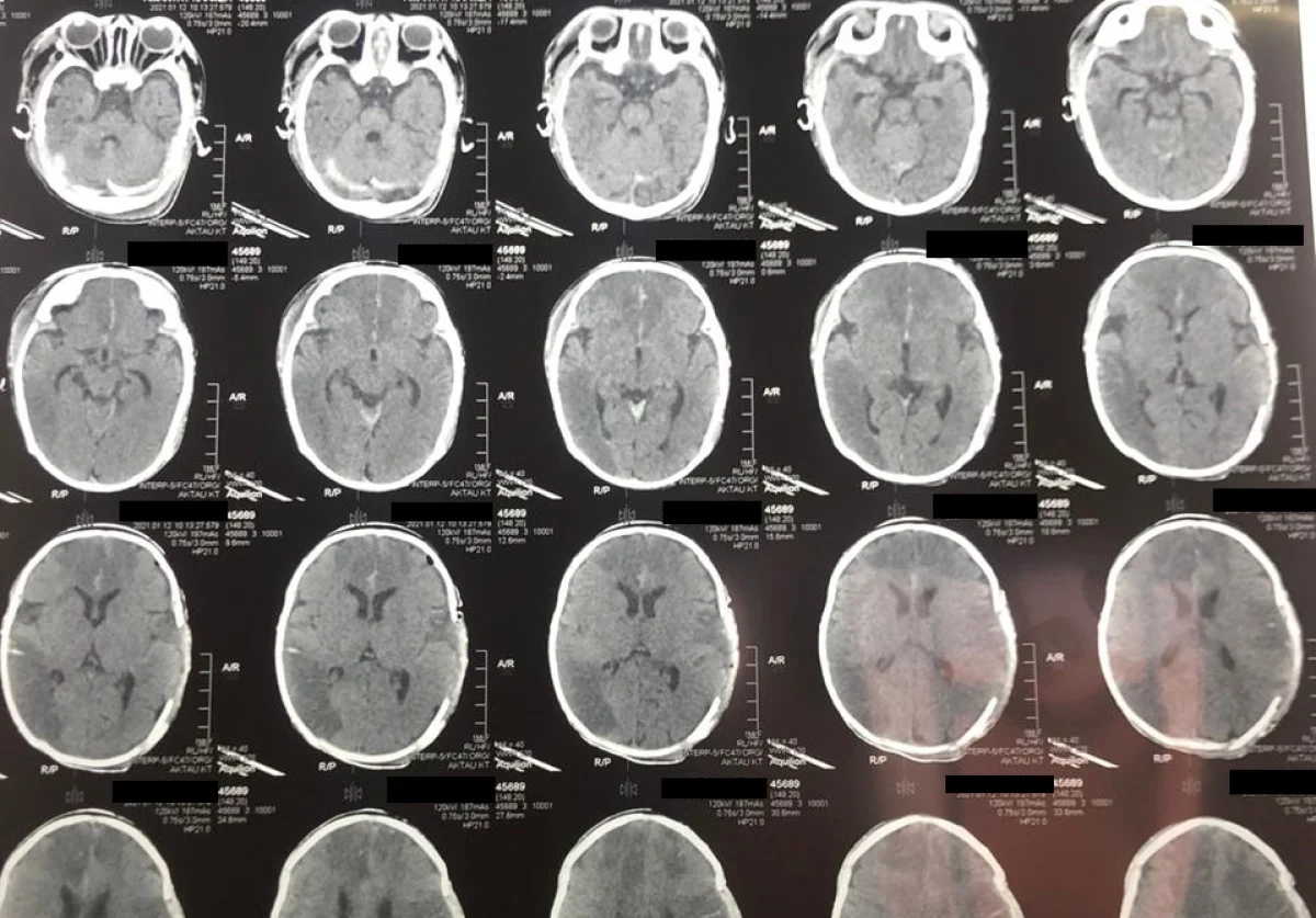 Фото предоставил Ербол Кенжевалов