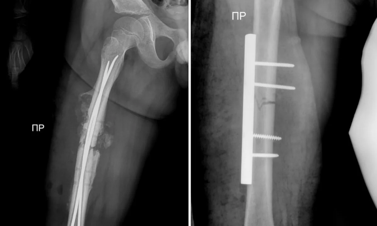 Фото предоставил Азамат Сарсенбаев