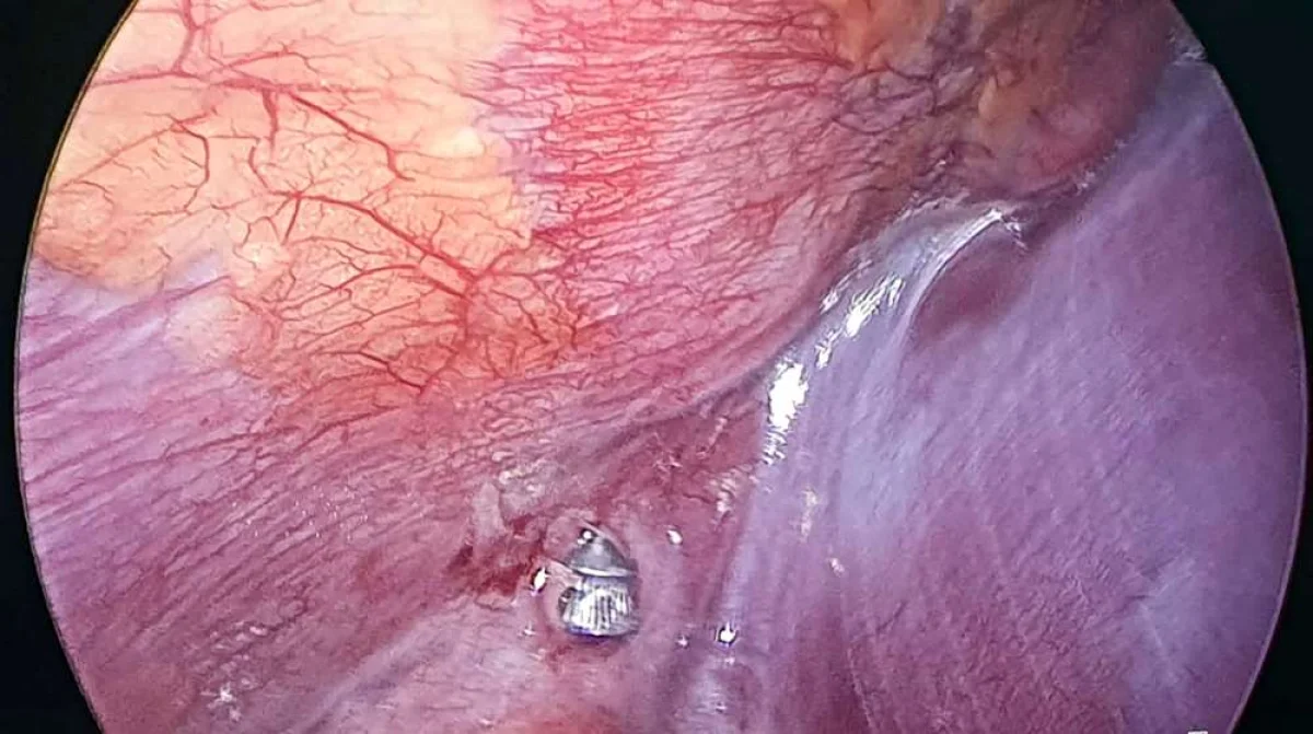 Фото предоставил Азамат Сарсенбаев