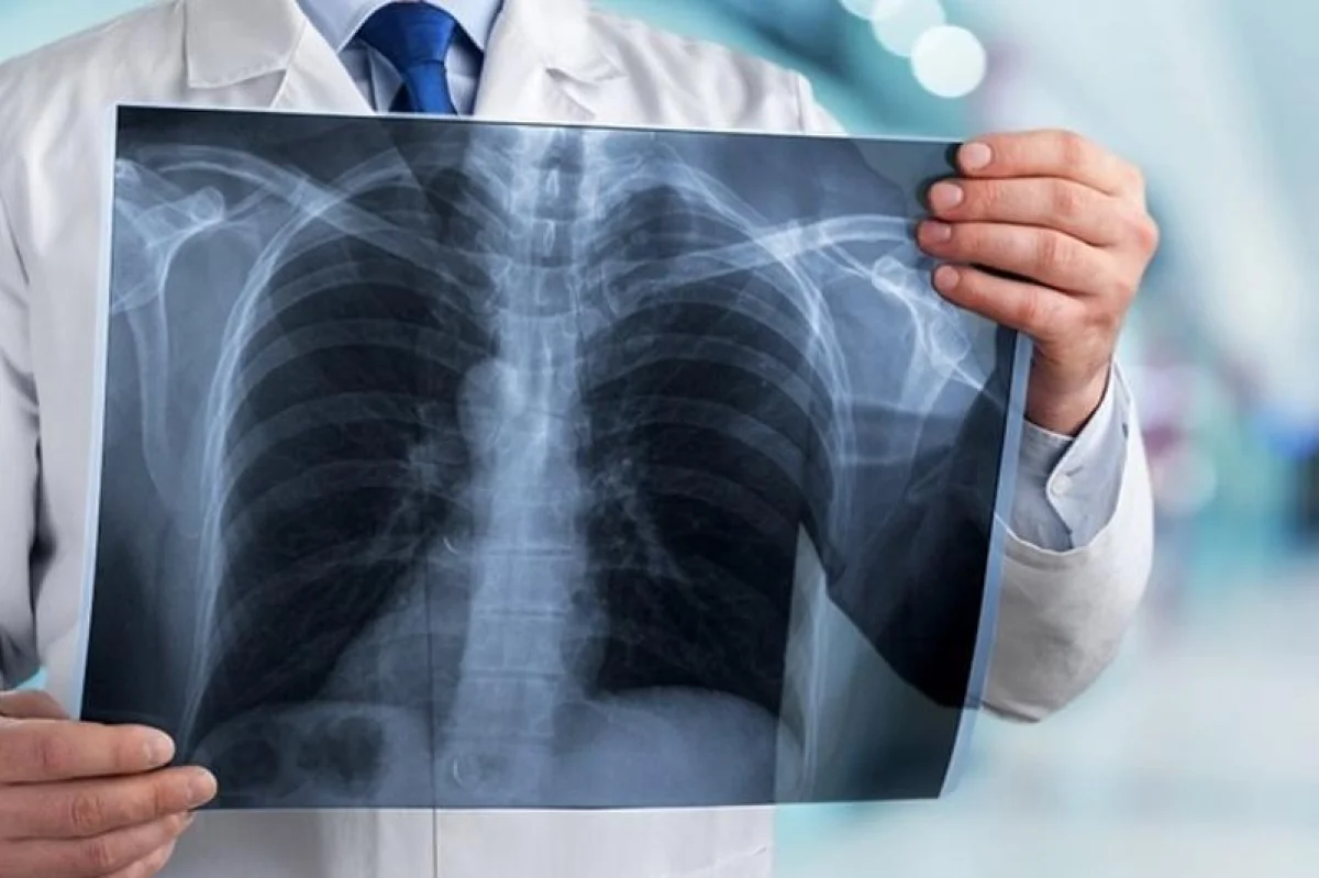 Иллюстративное фото