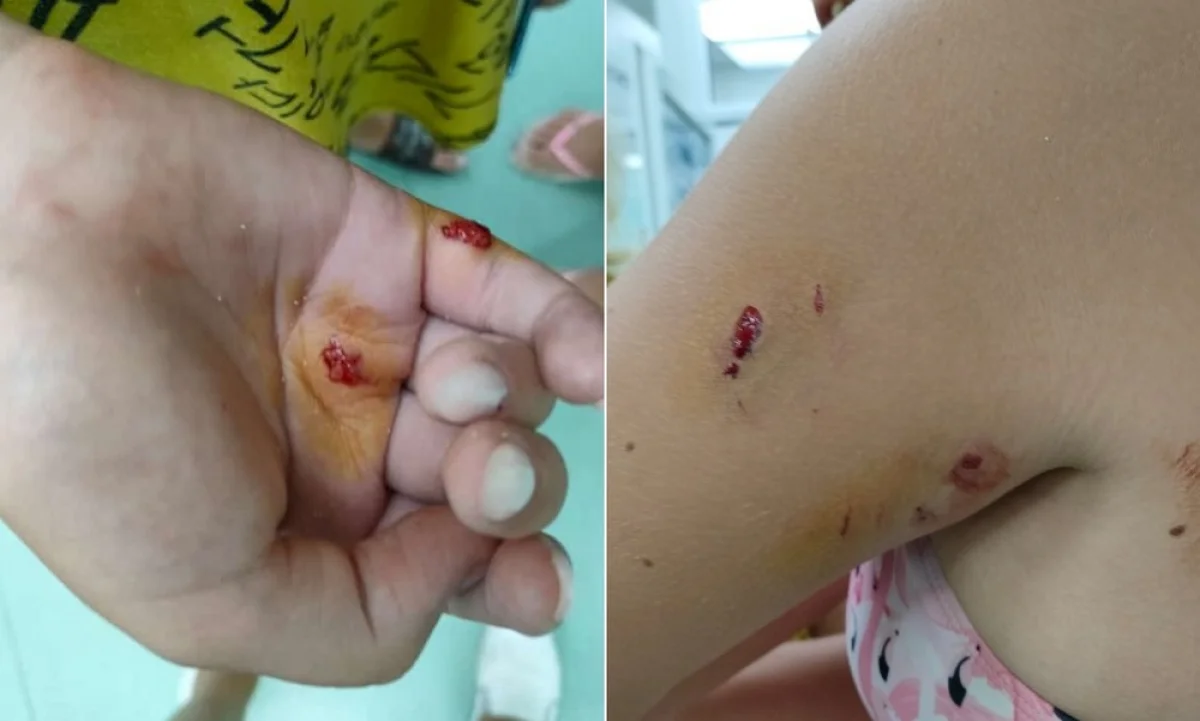 Фото предоставила мама одной из пострадавших девочек