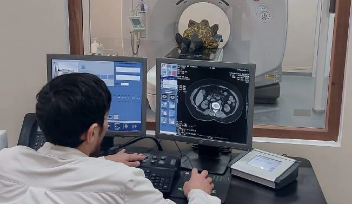 Низкодозная КТ. Фото предоставлено центром