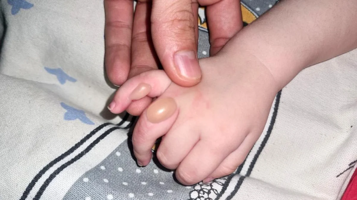 Фото травмы