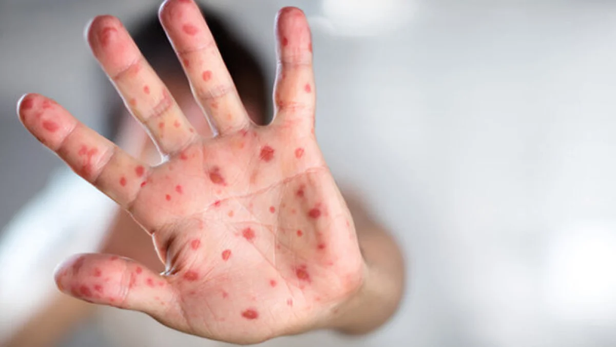 иллюстративное фото