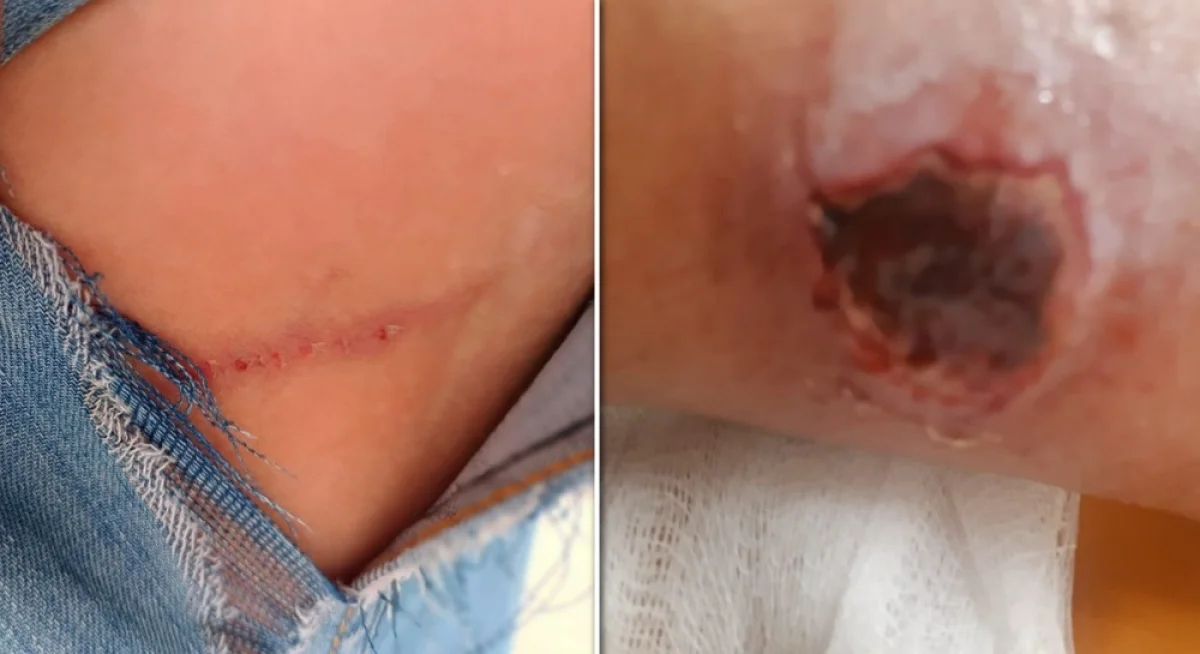 Последствия укусов безнадзорных собак. Фото предоставили в ИП «Redmaya»