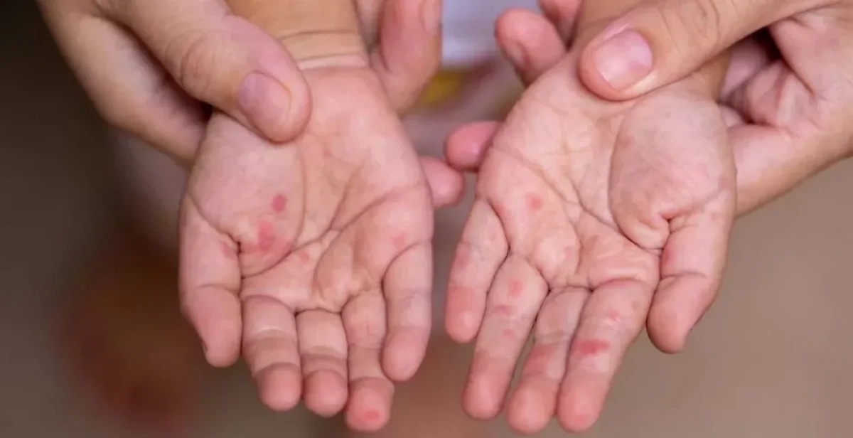 _фото из открытых источников