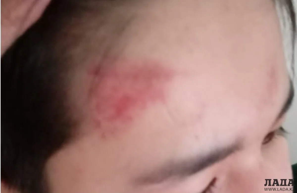 Фото предоставлено родителями пострадавшего