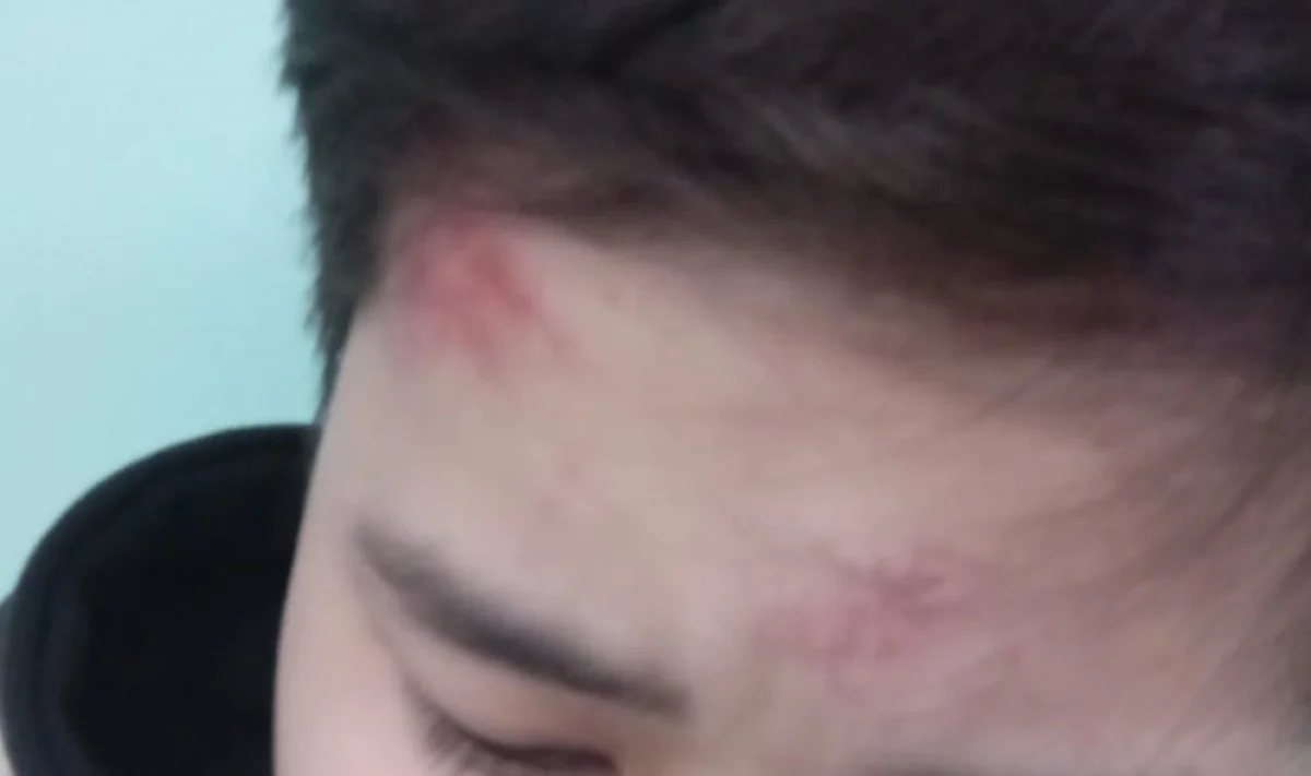 Фото предоставлено родителями пострадавшего