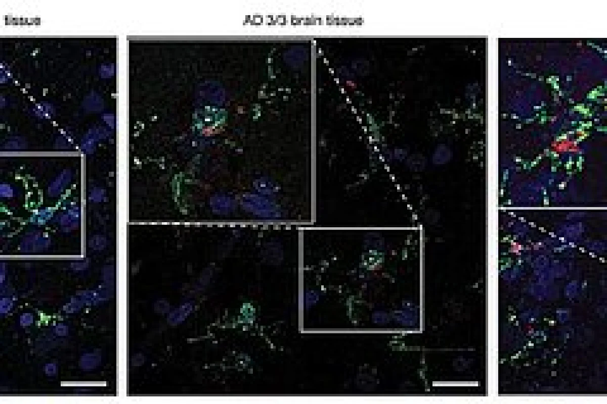 Изображение: Nature (2024) / medicalxpress.com