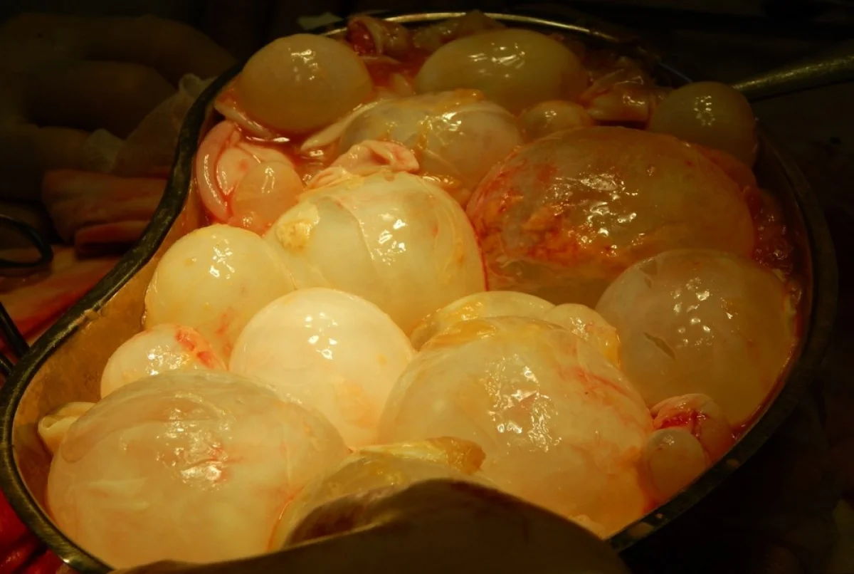 Фото с сайта medrazbor.ru