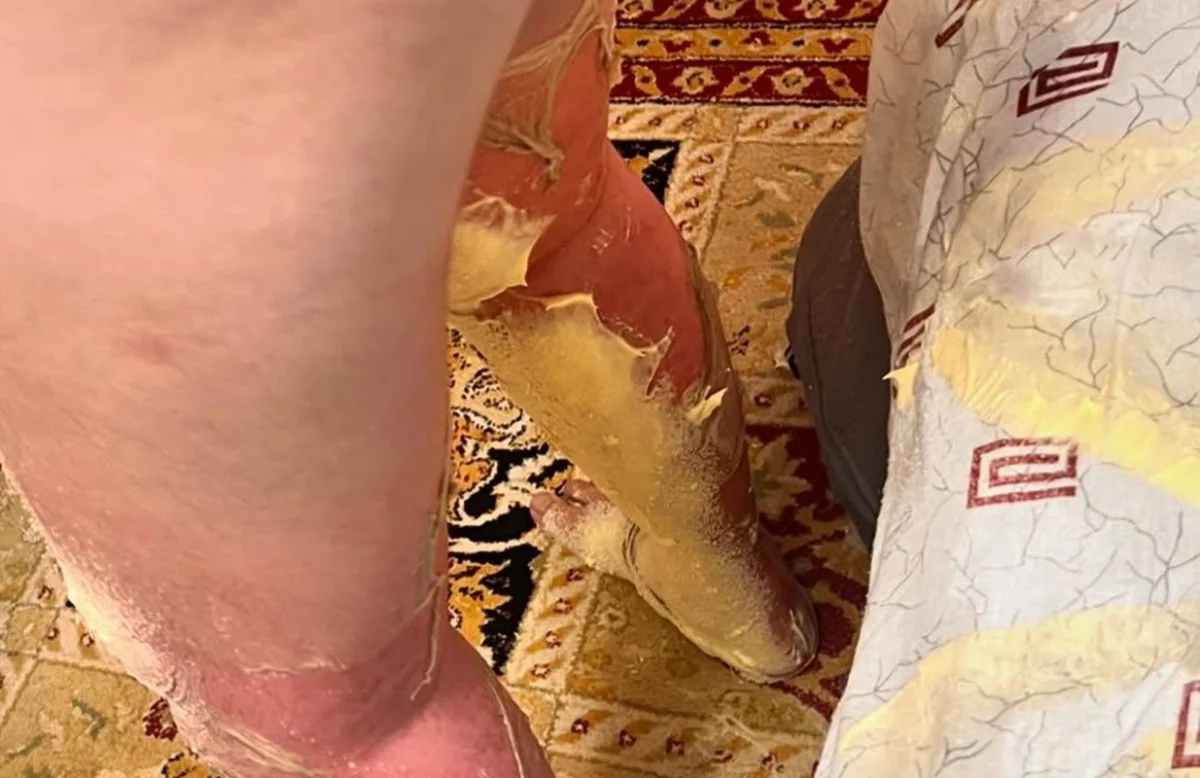 Фото предоставлено матерью пострадавшего