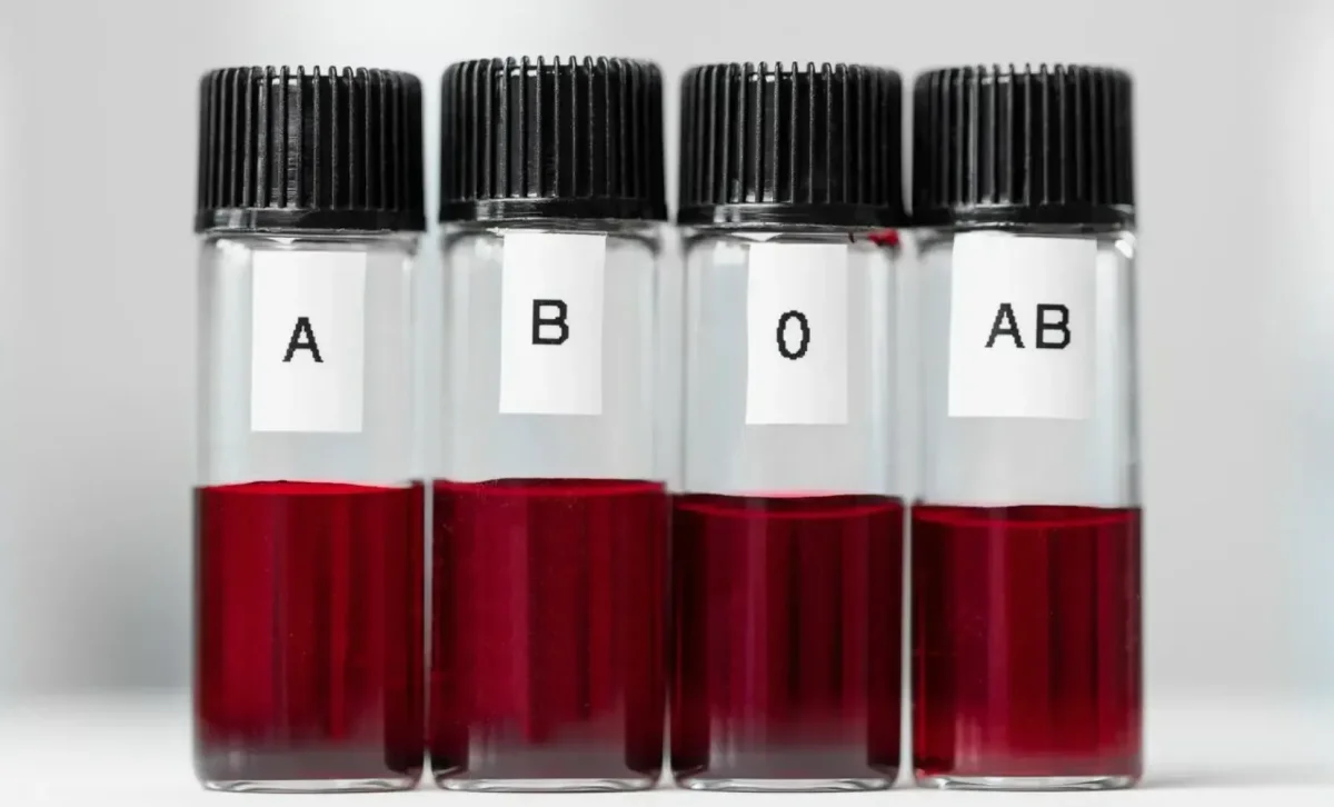 Фото: everydayhealth.com