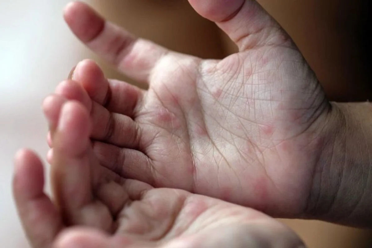 Фото: cmphmao.ru