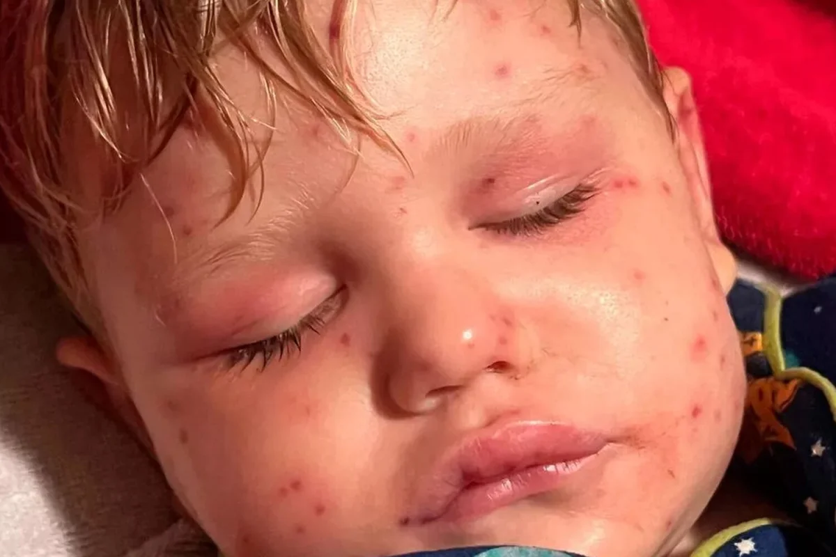 Фото: Go fund me