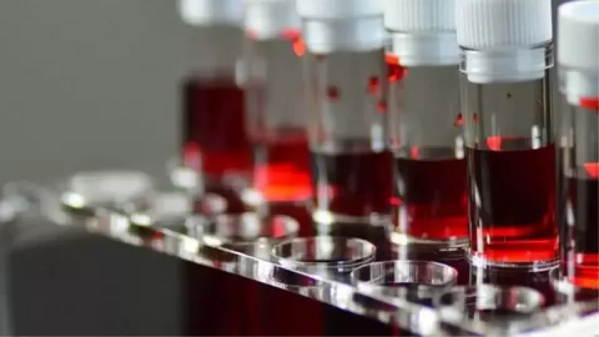 Фото: haberler.com