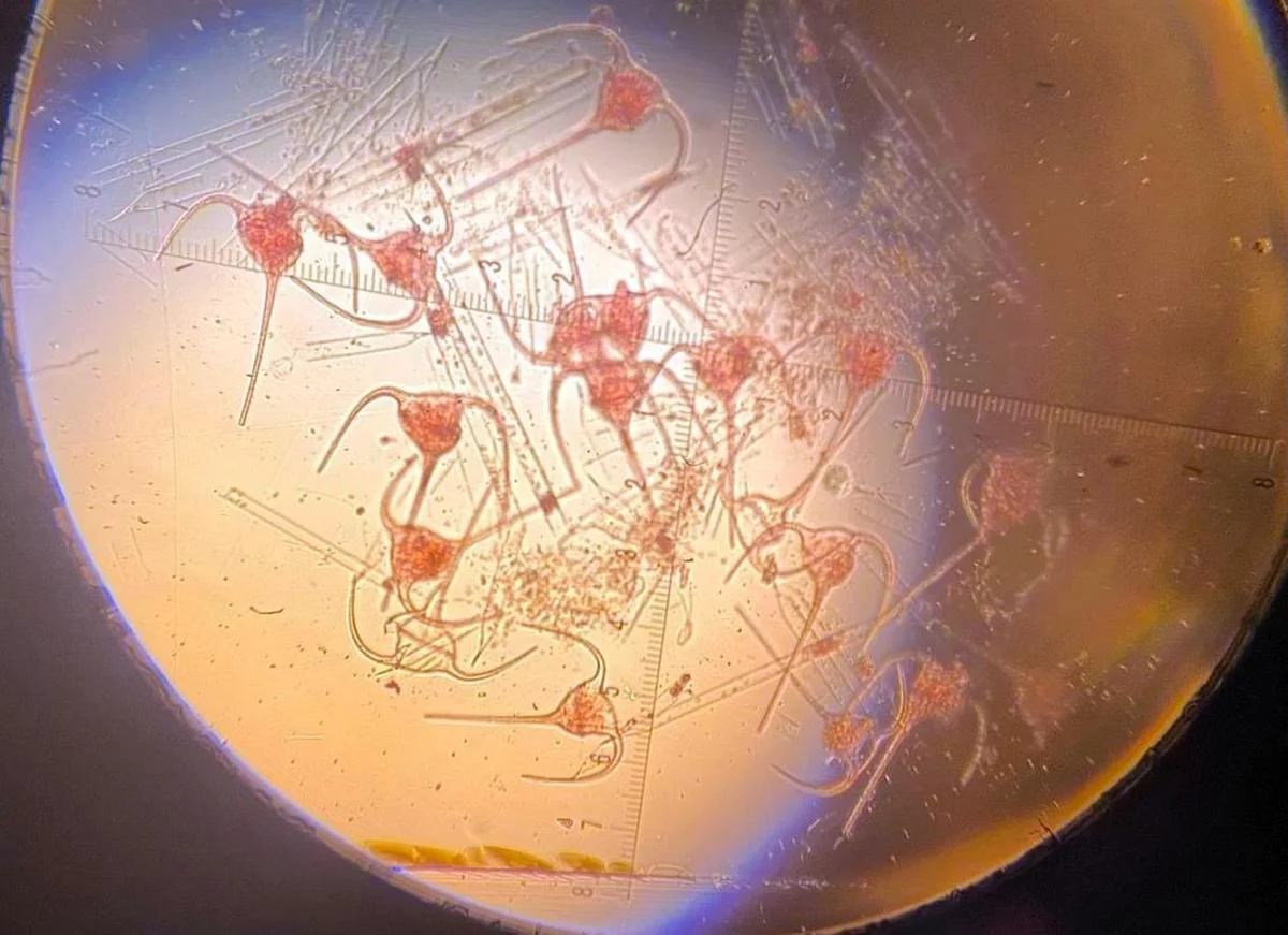 Ceratium tripos var. balticum в пробах в поверхностном слое воды (0-5 см) весной 2025 г. Фото «Волжско-Каспийский филиал» Каспийского научно-исследовательского института рыбного хозяйства