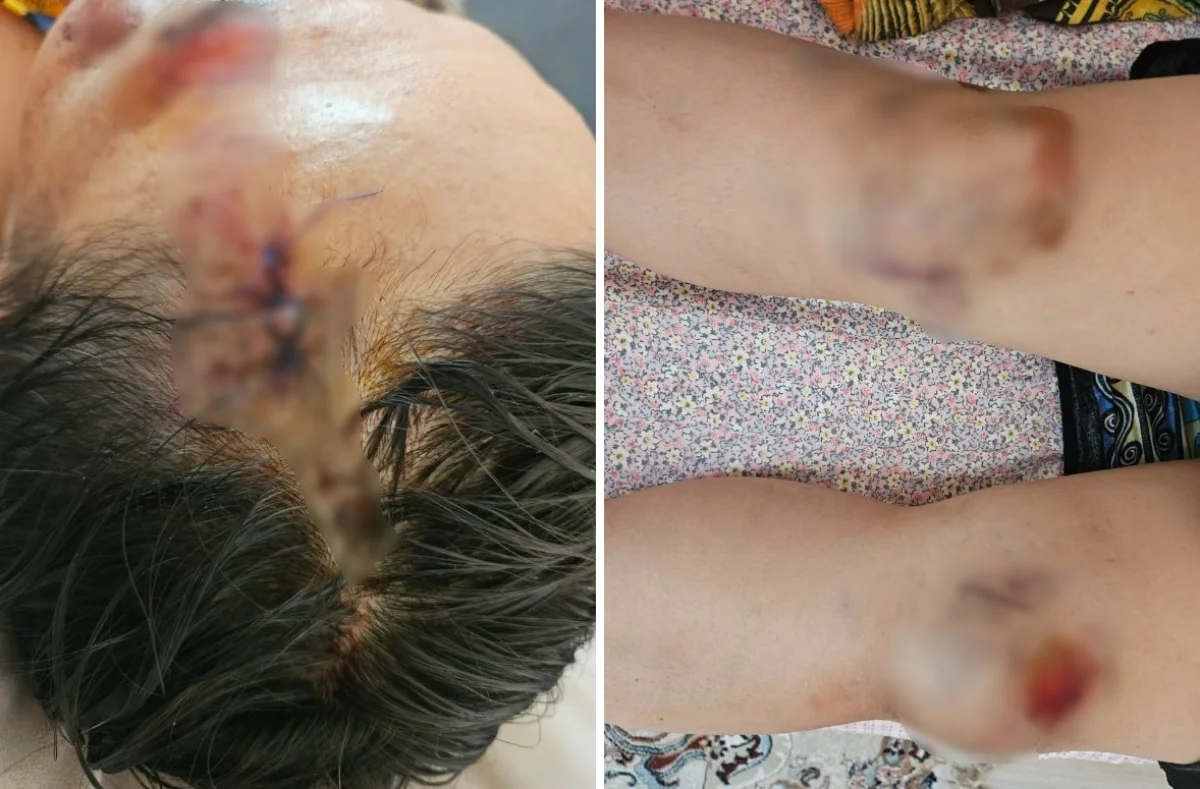 Фото предоставили родственники пострадавшей женщины