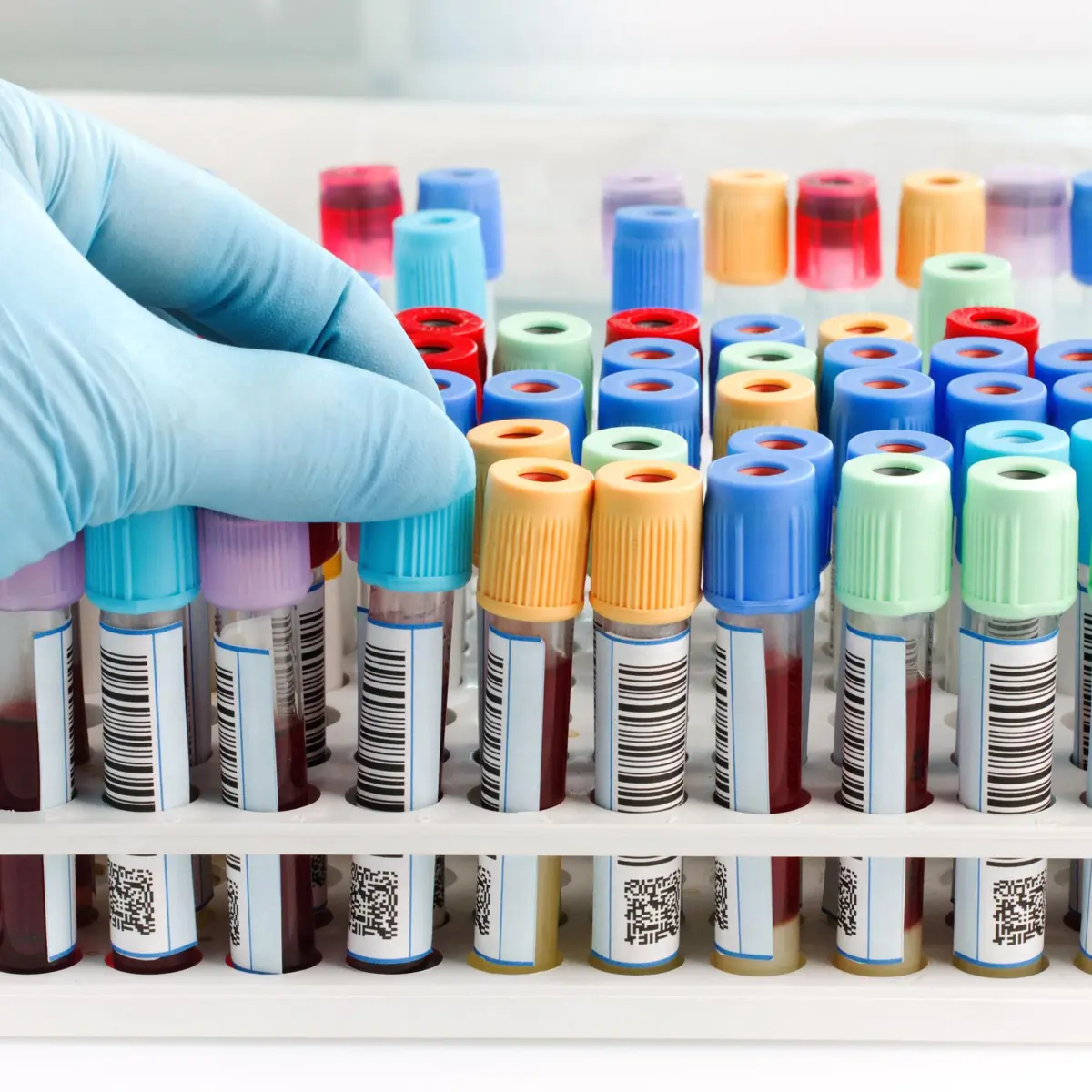 © Photo : AdobeStock