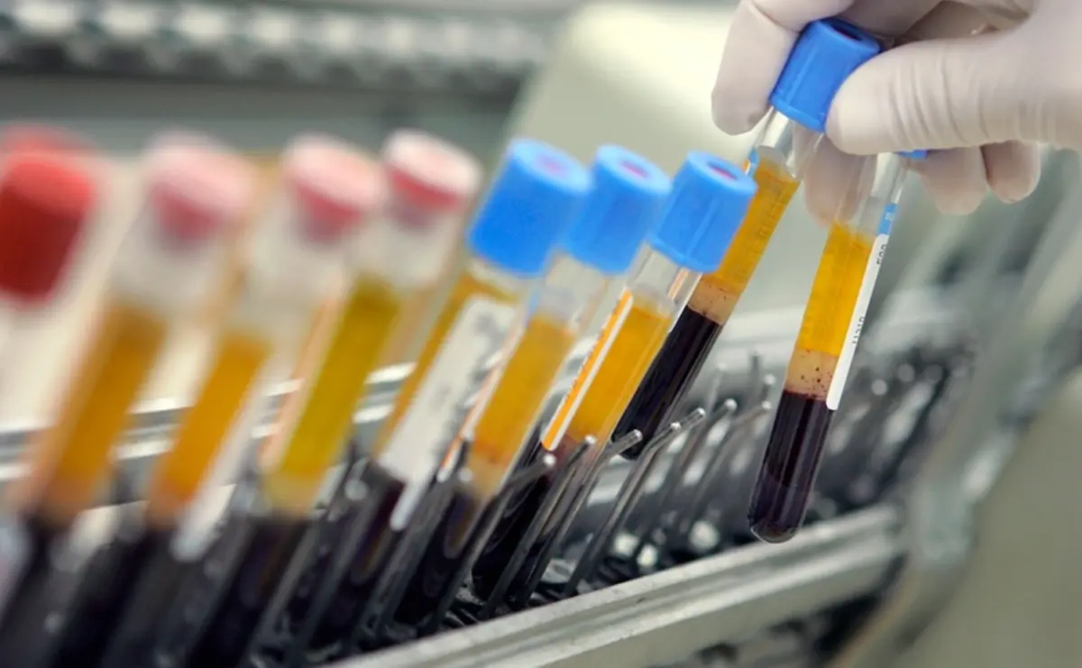 Фото: David Silverman / Getty Images