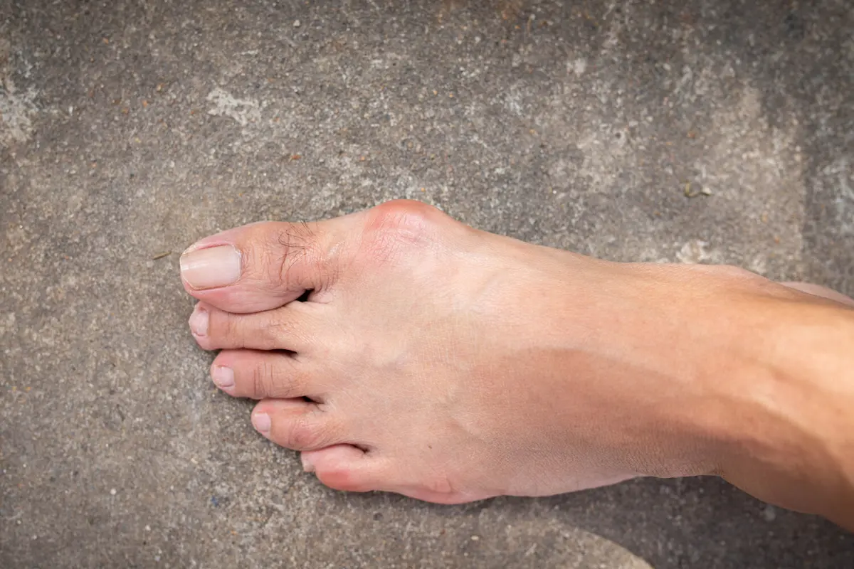 Фото: pemastockpic/Shutterstock/FOTODOM