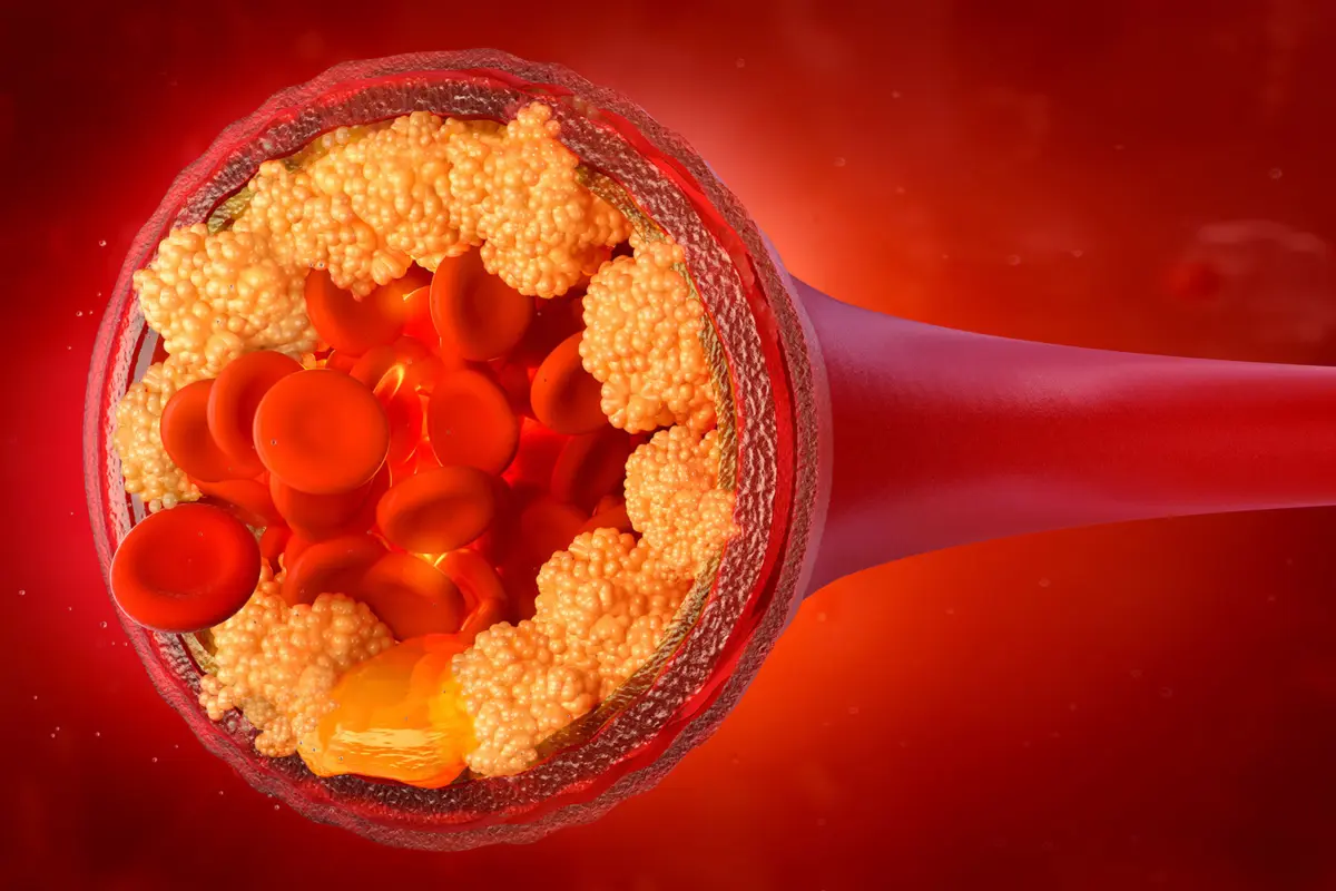 Фото:  Shutterstock