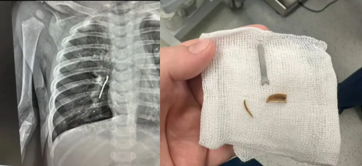 Фто: кадр видео