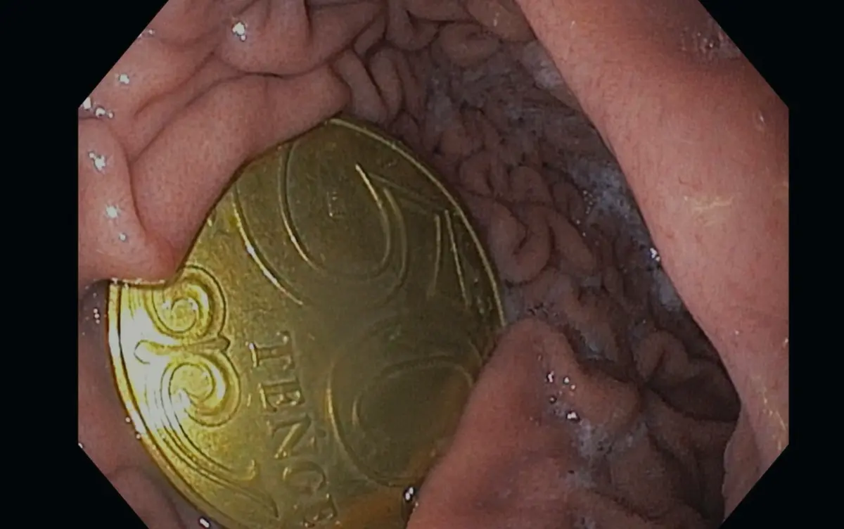 Фото: кадр видео