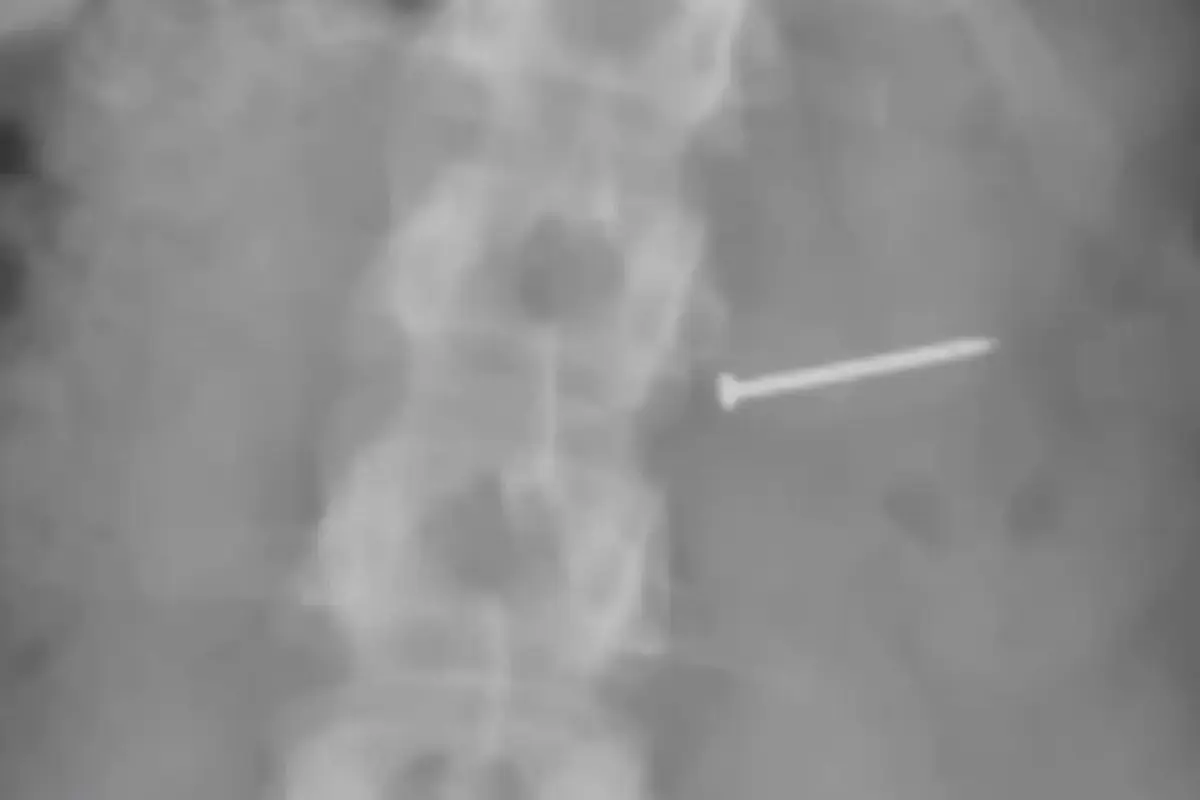 Фото: соцсети