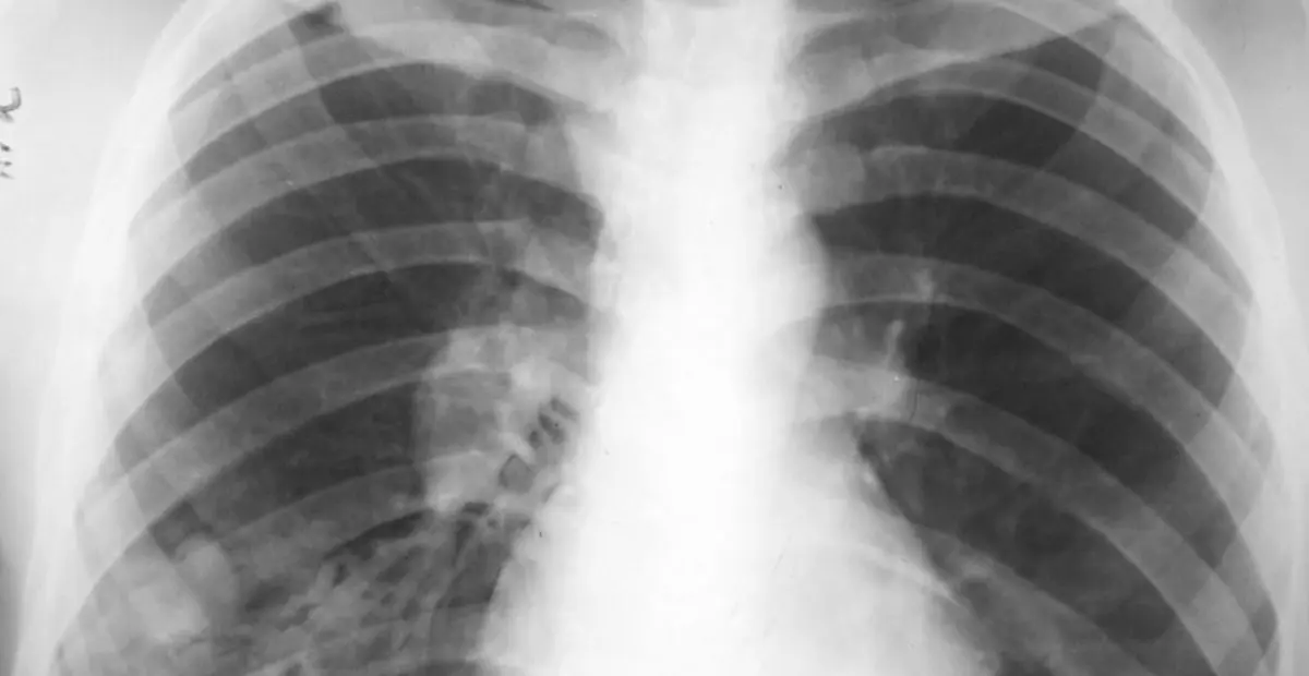 Фото с сайта thorax-clinic.ru
