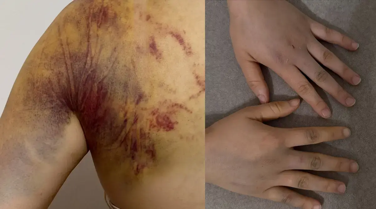 Фото предоставлено родственниками пострадавшей