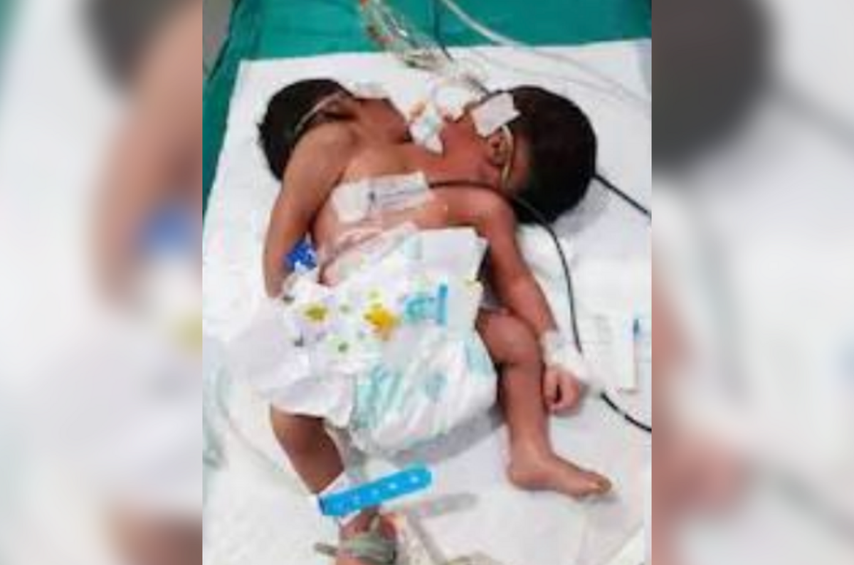 Фото: ndtv.com