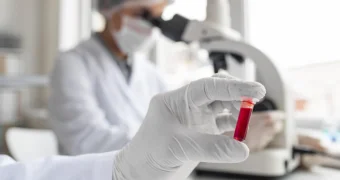 В Мангистау заболеваний Конго-Крымской геморрагической лихорадкой не зарегистрировано