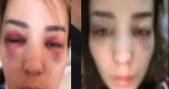 Заявившая о бытовом насилии жительница Актау обвинила полицию во лжи