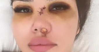 Сломал нос и угрожал обрезом: девушку избили на пляже в Актау