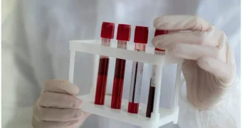 Ученые назвали группу крови, которой обладают успешные люди