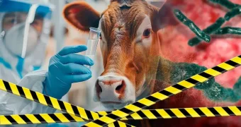 Сибирская язва подтвердилась у мясника в Атырау