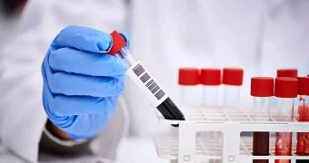 Ученые научились определять продолжительность жизни по крови